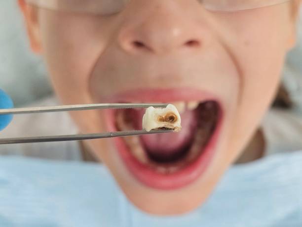 Best Pediatric Emergency Dentist in Gulf Park Estates, MS